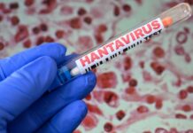 Evoluția cazului suspect de hantavirus în Arad: detalii cruciale oferite de DSP