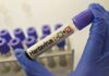 Nou caz de hantavirus în Arad: Autoritățile lansează o anchetă epidemiologică