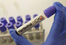 Nou caz de hantavirus în Arad: Autoritățile lansează o anchetă epidemiologică